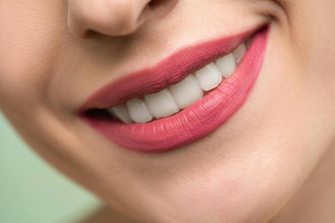 Clareamento Dental Caseiro: Mitos, Verdades e Cuidados